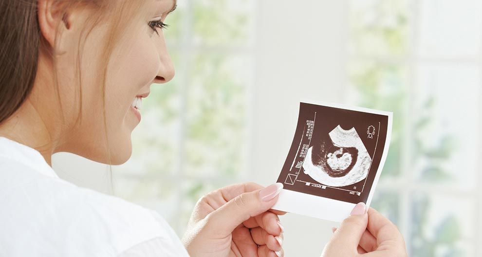 A woman in a white shirt holds an ultrasound image of a baby.